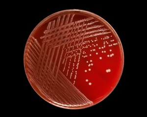 plate with colonies of staphylococcus epidermidis, gamma-hemolysis